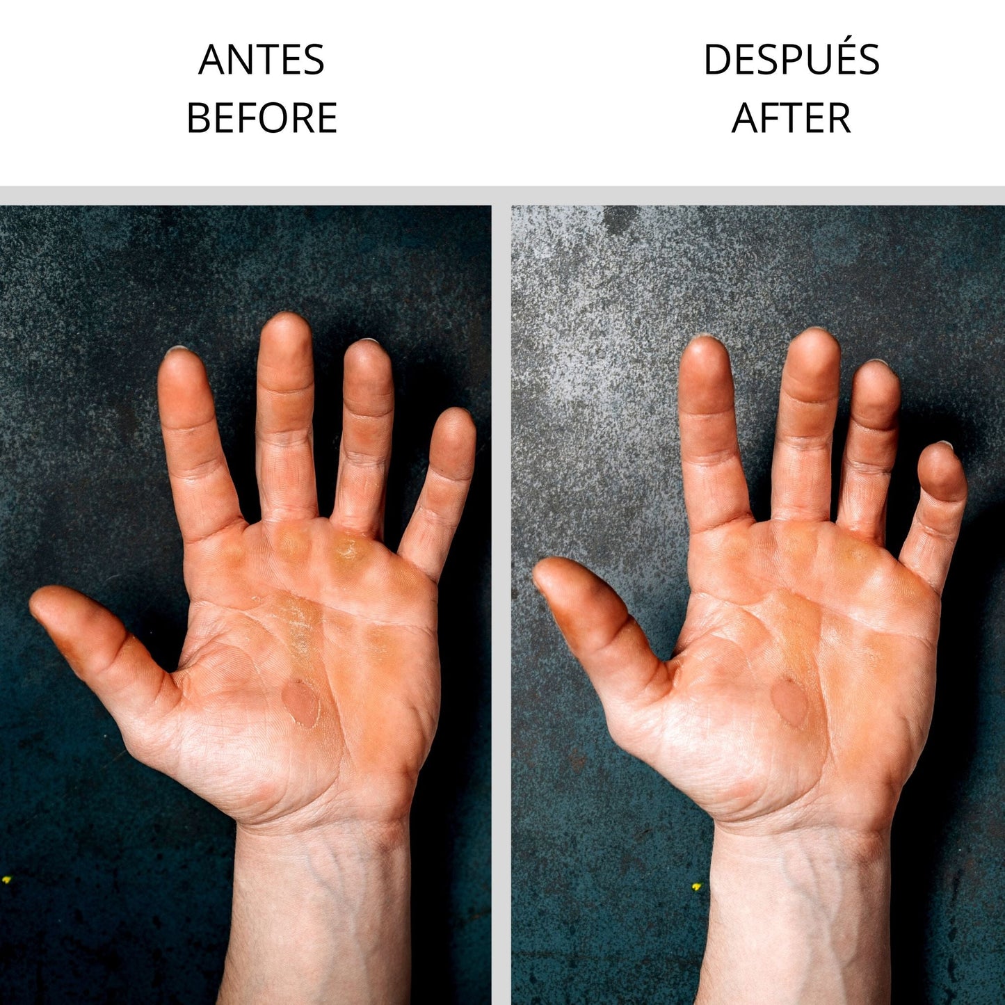 LIJA CALLOS ROCKY STONE